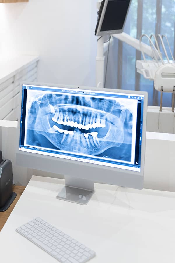 endodoncia-clinica-dental-ventosa-cordoba