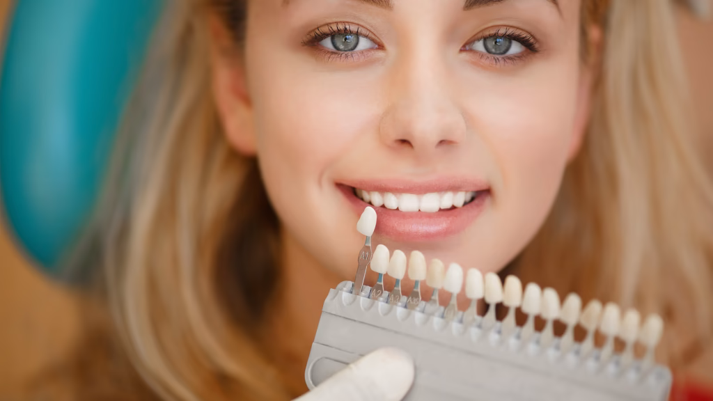 carillas-dentales-de-composite-clinica-ventosa-cordoba