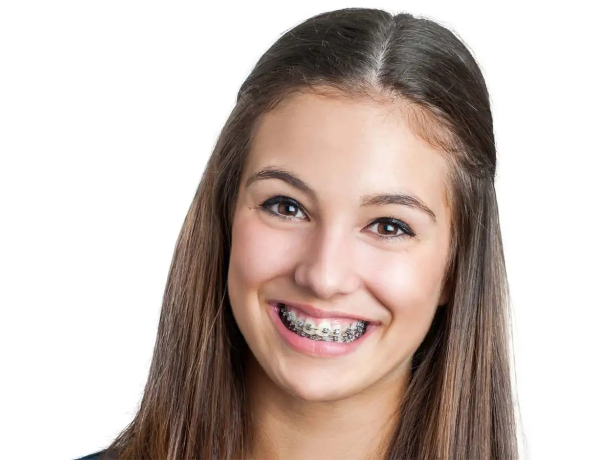 ortodoncia-estetica-en-adolescentes_clinica_ventosa