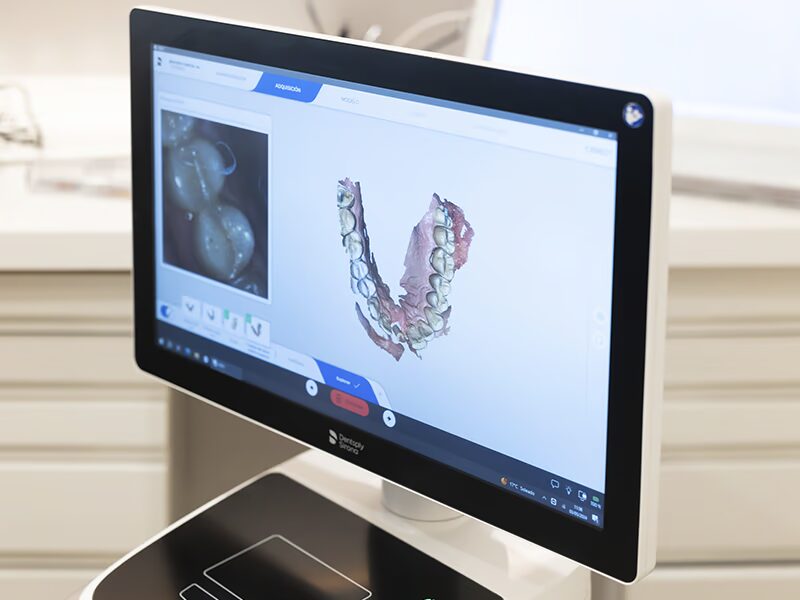 escaner-intraoral-sirona
