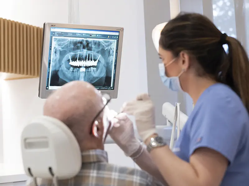 implantes-dentales-para-la-falta-de-dientes