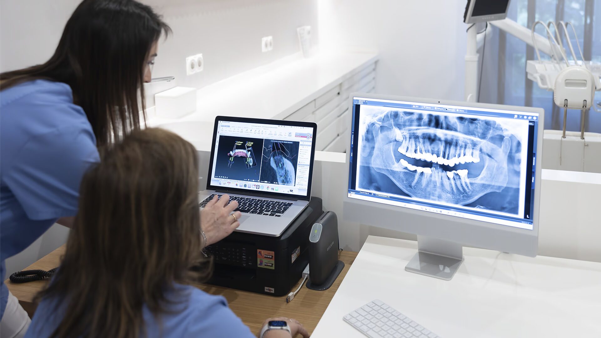 portada-que-pasa-si-no-me-coloco-un-implante-despues-de-perder-un-diente